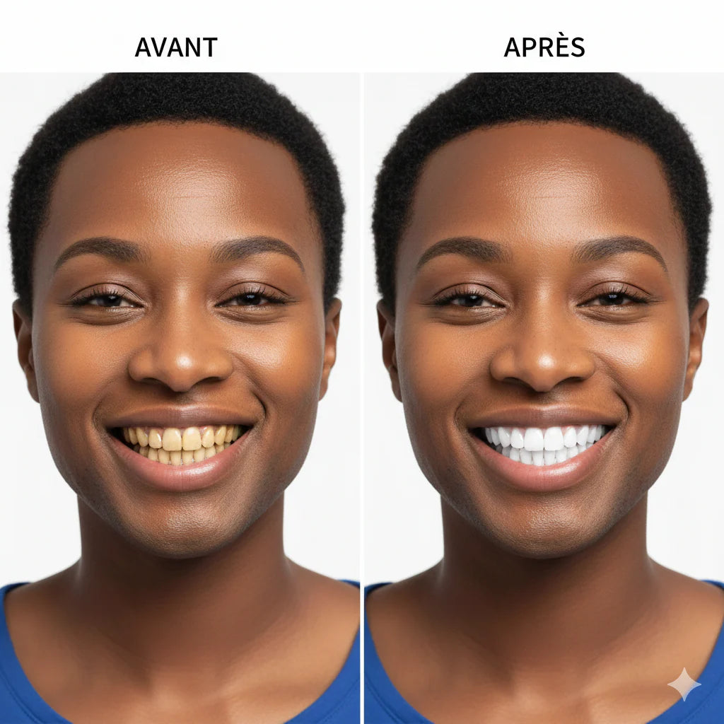 Glorysmile V34 Dentifrice Violet Blanchissant – Menthe Fraîche & Nettoyage Profond
 (6,432avis clients )