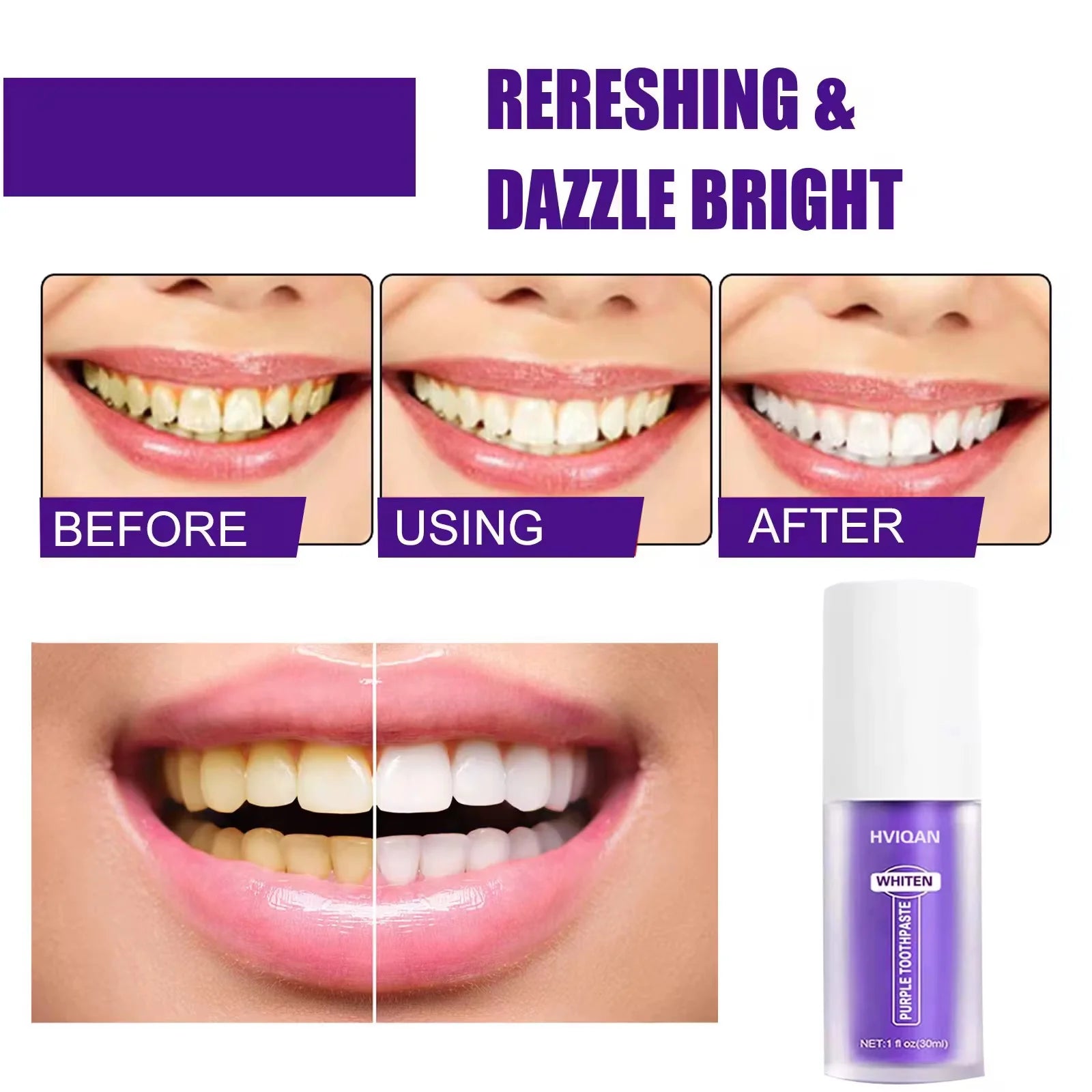 Glorysmile V34 Dentifrice Violet Blanchissant – Menthe Fraîche & Nettoyage Profond
 (6,432avis clients )