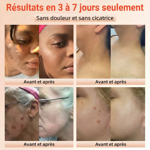Gel Exfoliant à L’huile d’orange